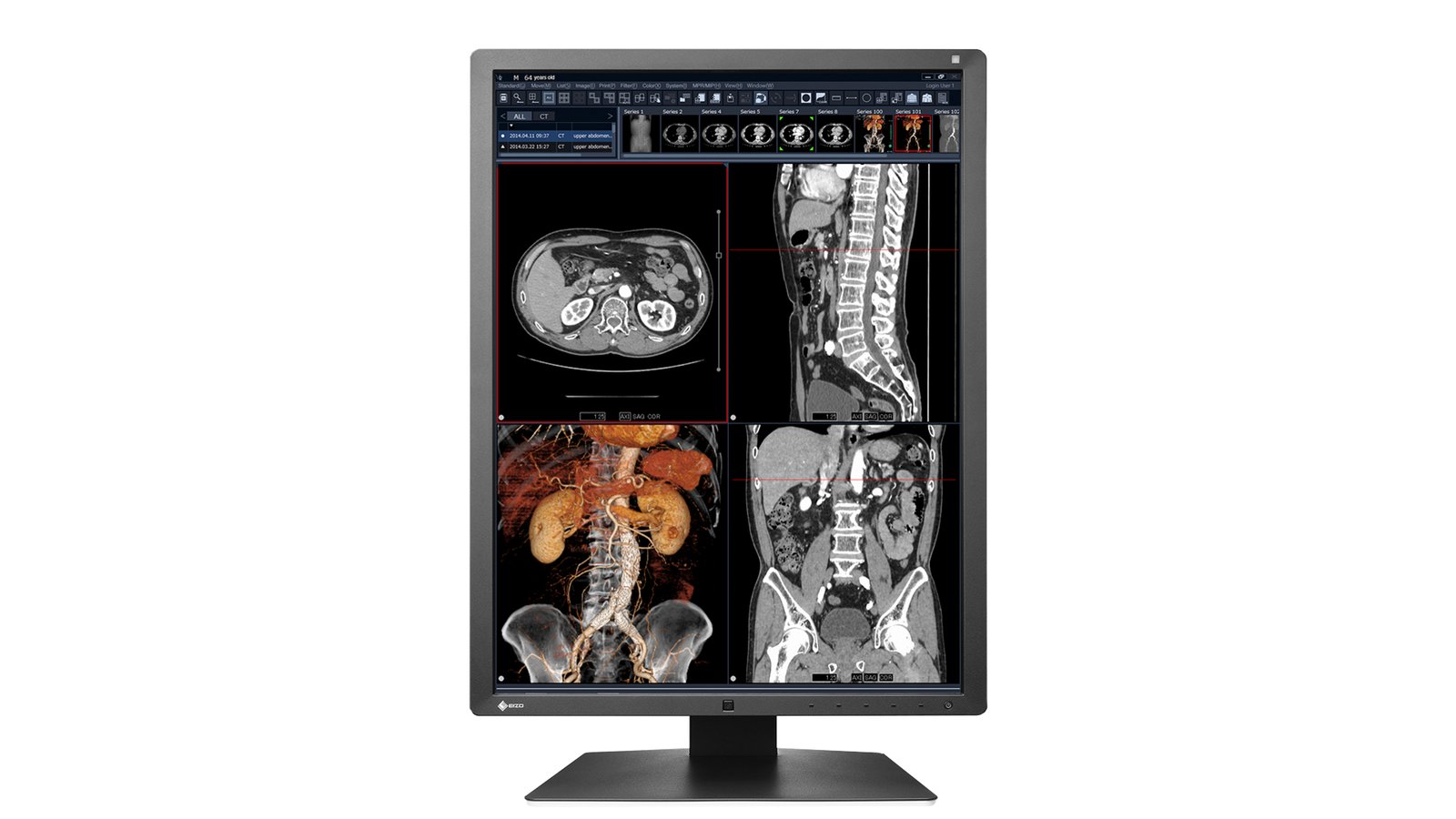 EIZO RadiForce RX250 computer monitor 54.1 cm (21.3") 1200 x 1600 pixels LCD Black RX250-BK