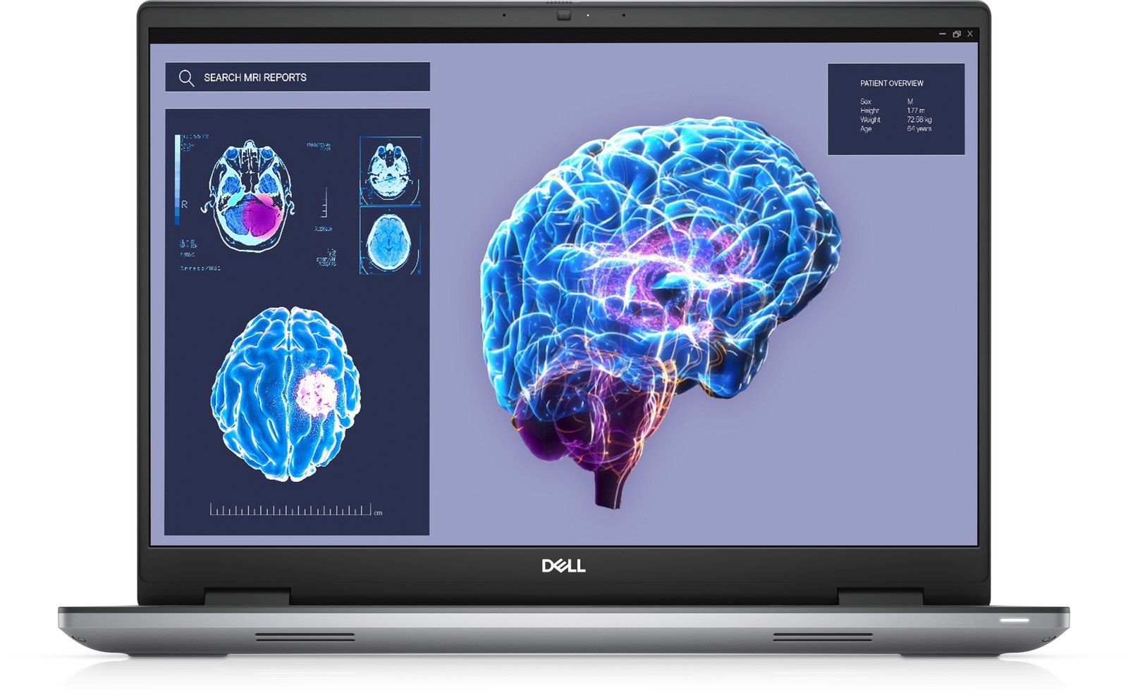 DELL Precision 7680 Intel® Core™ i7 i7-13850HX Mobile workstation 40.6 cm (16") Full HD+ 32 GB 210V1