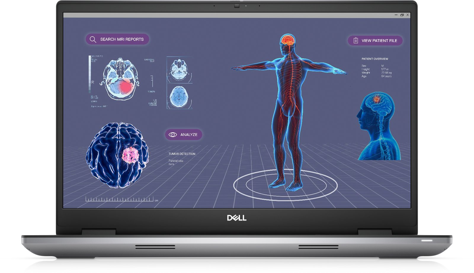 DELL Precision 7780 Intel® Core™ i7 i7-13850HX Mobile workstation 43.9 cm (17.3") Full HD 32 GB 26DYG